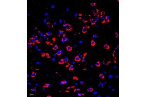 Immunofluorescence of paraffin embedded mouse brain using P4H (ABIN7074215) at dilution of 1:700 (400x lens) (HIF Prolyl Hydroxylase anticorps)