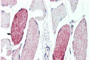 Human Skeletal Muscle (formalin-fixed, paraffin-embedded) stained with ACO2 antibody ABIN462115 followed by biotinylated goat anti-rabbit IgG secondary antibody ABIN481713, alkaline phosphatase-streptavidin and chromogen. (ACO2 anticorps  (AA 438-467))