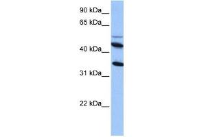 IL13RA2 antibody used at 1 ug/ml to detect target protein. (IL13RA2 anticorps  (Middle Region))