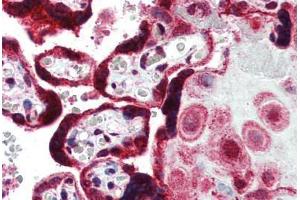 anti-Fermitin Family Member 1 (FERMT1) (AA 643-660) antibody