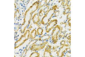 Immunohistochemistry of paraffin-embedded rat kidney using HSPA9 antibody.