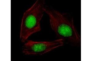Fluorescent image of U251 cells stained with SREBP2 antibody.
