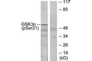 Western blot analysis of extracts from ovary cancer, using GSK3 alpha (Phospho-Ser21) Antibody. (GSK3 alpha anticorps  (AA 10-59))