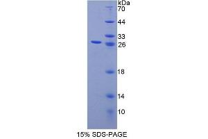 SDS-PAGE analysis of Human CHP Protein. (CHP Protéine)