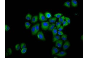 Immunofluorescence staining of Hela cells with ABIN7154190 at 1:200, counter-stained with DAPI. (GLRB anticorps  (AA 355-472))