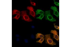 ABIN6265851 and ABIN6278192 staining Hela cells by IF/ICC. (UBE2L6 anticorps  (C-Term))