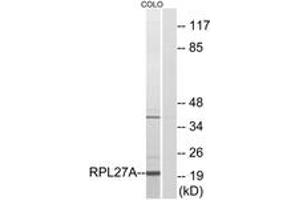 Western blot analysis of extracts from COLO cells, using RPL27A Antibody. (RPL27A anticorps  (AA 99-148))