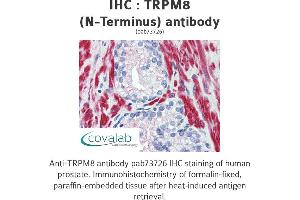Image no. 2 for anti-Transient Receptor Potential Cation Channel, Subfamily M, Member 8 (TRPM8) (Cytoplasmic Domain), (N-Term) antibody (ABIN1740398) (TRPM8 anticorps  (Cytoplasmic Domain, N-Term))