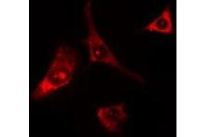ABIN6275680 staining Hela cells by IF/ICC. (WIPF1 anticorps  (C-Term))