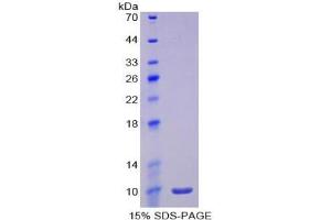 SDS-PAGE of Protein Standard from the Kit  (Highly purified E. (IL-6 Receptor Kit ELISA)