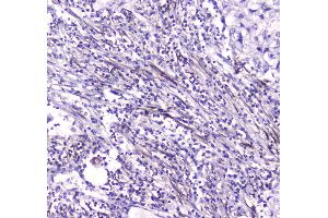 IHC analysis of CES1 using anti-CES1 antibody .