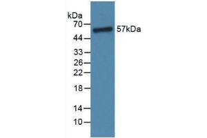 Western blot analysis of Rat Lung Tissue. (Angiopoietin 1 anticorps  (AA 304-450))