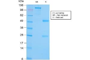 anti-Heat Shock Protein 90kDa beta (Grp94), Member 1 (HSP90B1) antibody