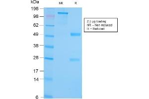 SDS-PAGE Analysis Purified GRP94 Recombinant Rabbit Monoclonal (HSP90B1/3168R). (Recombinant GRP94 anticorps)