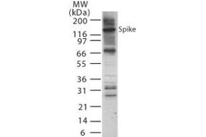 Image no. 1 for anti-SARS-Coronavirus Spike Protein (SARS-CoV S) (AA 755-769) antibody (ABIN200034) (SARS-CoV Spike anticorps  (AA 755-769))
