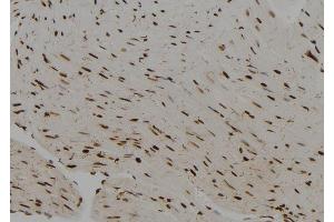ABIN6279641 at 1/100 staining Rat heart tissue by IHC-P. (PRRX2 anticorps  (Internal Region))