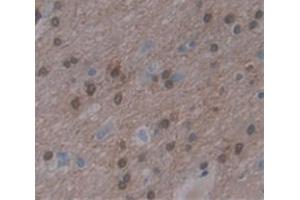 Used in DAB staining on fromalin fixed paraffin- embedded Kidney tissue (KHDRBS1 anticorps  (AA 152-381))