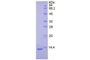 SDS-PAGE of Protein Standard from the Kit  (Highly purified E. (PLAT Kit ELISA)