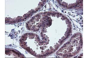 Immunohistochemical staining of paraffin-embedded Human breast tissue using anti-FGFR2 mouse monoclonal antibody. (FGFR2 anticorps)