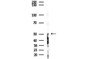 anti-Zinc Finger, FYVE Domain Containing 19 (ZFYVE19) (Internal Region) antibody