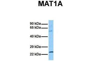 Host:  Rabbit  Target Name:  MAT1A  Sample Tissue:  Human Ovary Tumor  Antibody Dilution:  1. (MAT1A anticorps  (C-Term))