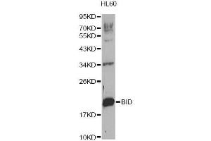 Western blot analysis of extracts of HL-60 cells, using BID Antibody. (BID anticorps  (AA 1-130))