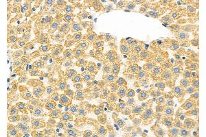 ABIN6260778 and ABIN6277329 at 1/100 staining Rat liver tissue by IHC-P. (CFHR1 anticorps  (C-Term))