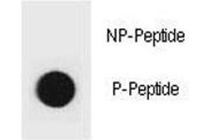 Dot blot analysis of phospho-PTEN antibody. (PTEN anticorps  (pTyr315))