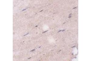 Immunohistochemistry of FNIP2 in mouse skeletal muscle tissue with FNIP2 antibody at 5 μg/ml. (FNIP2 anticorps  (C-Term))