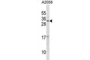 Western Blotting (WB) image for anti-Ribonuclease, RNase A Family, 9 (Non-Active) (RNASE9) antibody (ABIN3001184) (RNASE9 anticorps)