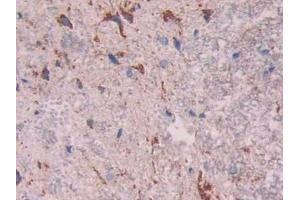 Detection of CTSD in Rat Spinal cord Tissue using Polyclonal Antibody to Cathepsin D (CTSD) (Cathepsin D anticorps  (AA 120-407))