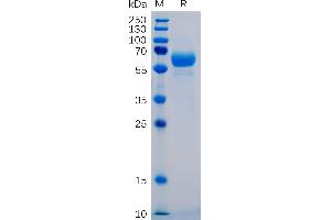 Human SIG Protein, mFc-His Tag on SDS-PAGE under reducing condition.