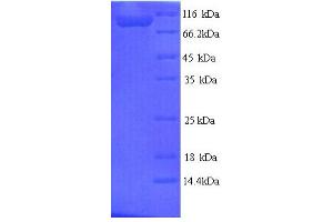 SDS-PAGE (SDS) image for tau Protein (AA 2-752) protein (His tag) (ABIN5713630)