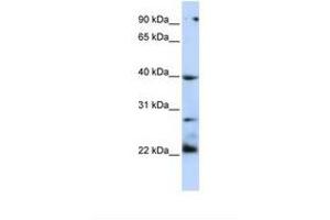Image no. 1 for anti-Tumor Necrosis Factor Receptor Superfamily, Member 10b (TNFRSF10B) (AA 38-87) antibody (ABIN6739076)