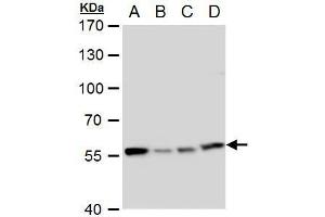 WB Image TCP1 eta antibody [C1C3] detects TCP1 eta protein by western blot analysis. (CCT7 anticorps  (C-Term))