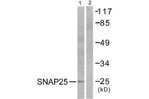 Western Blotting (WB) image for anti-Synaptosomal-Associated Protein, 25kDa (SNAP25) (C-Term) antibody (ABIN1848775) (SNAP25 anticorps  (C-Term))