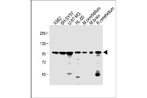 All lanes : Anti-DNAJC6 Antibody (Center) at 1:2000 dilution Lane 1: K562 whole cell lysate Lane 2: SH-SY5Y whole cell lysate Lane 3: U-87 MG whole cell lysate Lane 4: HL-60 whole cell lysate Lane 5: mouse cerebellum lysate Lane 6: mouse brain lysate Lane 7: rat cerebellum lysate Lysates/proteins at 20 μg per lane. (DNAJC6 anticorps  (AA 254-281))