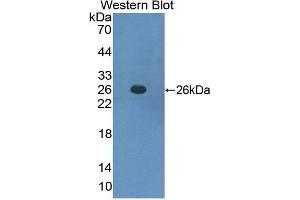 Western Blotting (WB) image for anti-Interferon alpha/beta Receptor 1 (IFNAR1) (AA 28-227) antibody (ABIN1859262) (IFNAR1 anticorps  (AA 28-227))