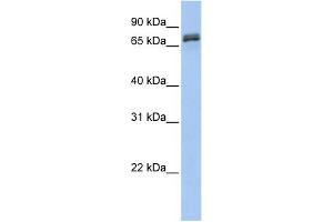 WB Suggested Anti-DYNC1I1 Antibody Titration: 0. (DYNC1I1 anticorps  (N-Term))