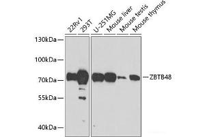 Western blot analysis of extracts of various cell lines using ZBTB48 Polyclonal Antibody at dilution of 1:1000. (ZBTB48 anticorps)