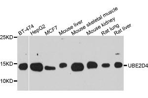 Western blot analysis of extracts of various cell lines, using UBE2D4 antibody (ABIN5974832) at 1/1000 dilution. (UBE2D4 anticorps)