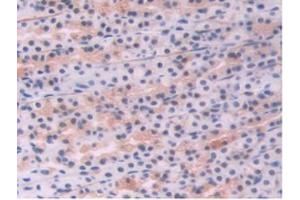 IHC-P analysis of Rat Stomach Tissue, with DAB staining. (Endoglin anticorps  (AA 26-136))