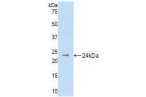 Detection of Recombinant DHH, Mouse using Polyclonal Antibody to Hedgehog Homolog, Desert (DHH)