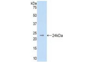 Detection of Recombinant DHH, Mouse using Polyclonal Antibody to Hedgehog Homolog, Desert (DHH) (desert Hedgehog anticorps  (AA 212-392))