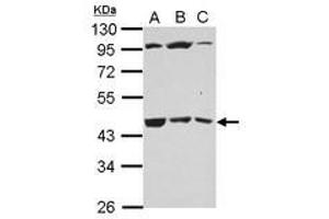 Image no. 2 for anti-UDP-Gal:betaGlcNAc beta 1,3-Galactosyltransferase, Polypeptide 4 (B3GALT4) (AA 123-357) antibody (ABIN1496798) (B3GALT4 anticorps  (AA 123-357))