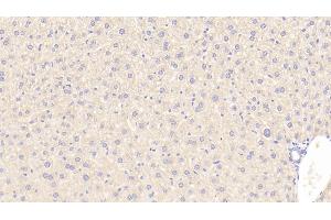 Detection of SFXN1 in Mouse Liver Tissue using Polyclonal Antibody to Sideroflexin 1 (SFXN1)