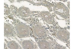 ABIN6266140 and ABIN6272491 at 1/100 staining human normal colon tissue by IHC-P.