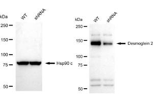 Western blotting analysis using Desmoglein 2 antibody (ABIN7798317).