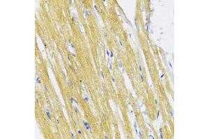 Immunohistochemistry of paraffin-embedded rat heart using IKBKE antibody.