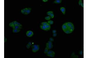 Immunofluorescent analysis of HepG2 cells using ABIN7148441 at dilution of 1:100 and Alexa Fluor 488-congugated AffiniPure Goat Anti-Rabbit IgG(H+L) (CTGF anticorps  (AA 253-349))